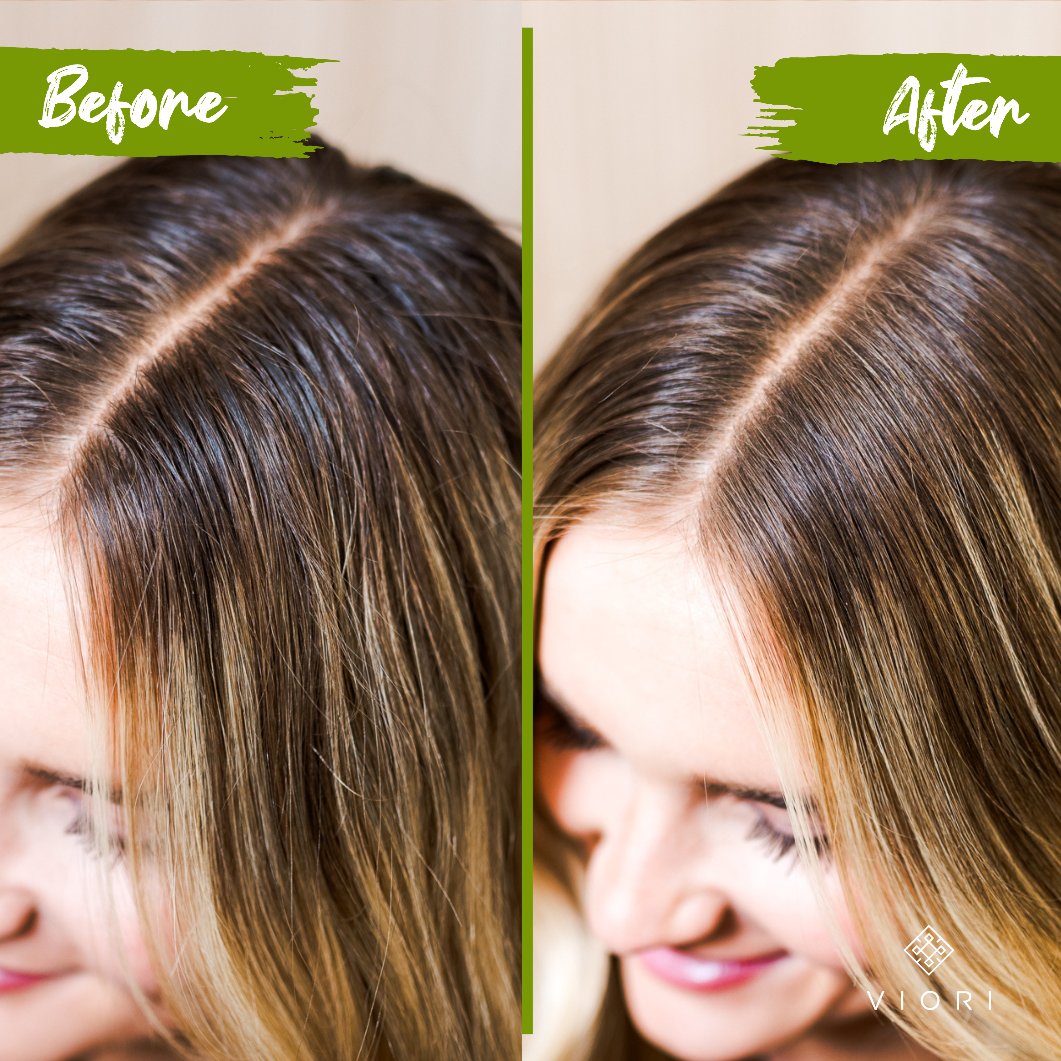 Dry Shampoo | Vanilla Coconut